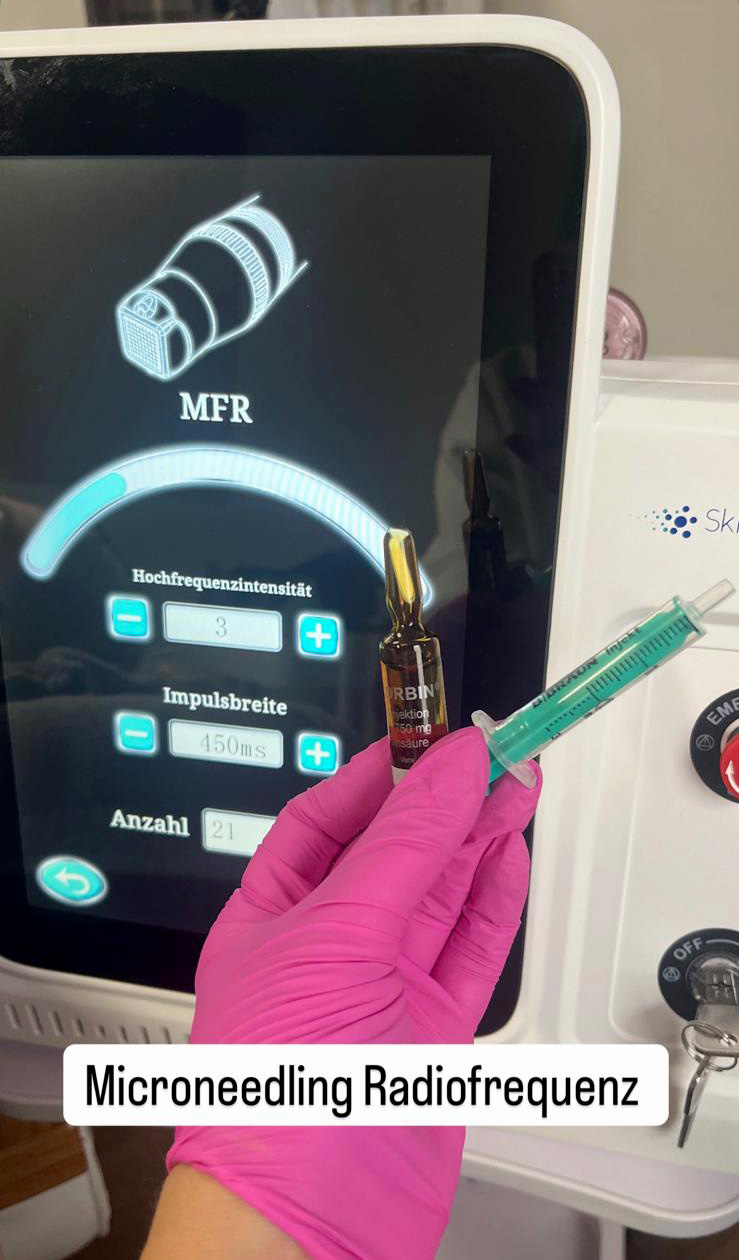 Microneedling in Möglingen by beautysecret